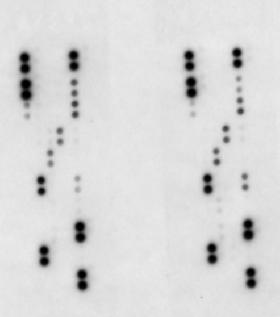 IL-5 sérica (pg/ml) VEGF sérica (pg/ml) RESULTADOS Para analizar de forma más detallada el perfil de los mediadores implicados en el proceso inflamatorio, se realizó un array de citocinas en el que