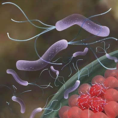 Cómo se hace la detección de la bacteria Helicobacter pylori? Qué es la panendoscopía? Qué es la manometría esofágica? Qué es el monitoreo del ph esofágico (ph-metría)?