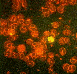 Detección del Ag temprano pp65 por Inmunofluorescencia pp65