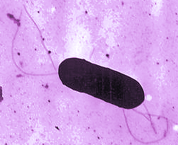 Contenido o Presentación. o Listeria monocytogenes: presencia y peligrosidad.