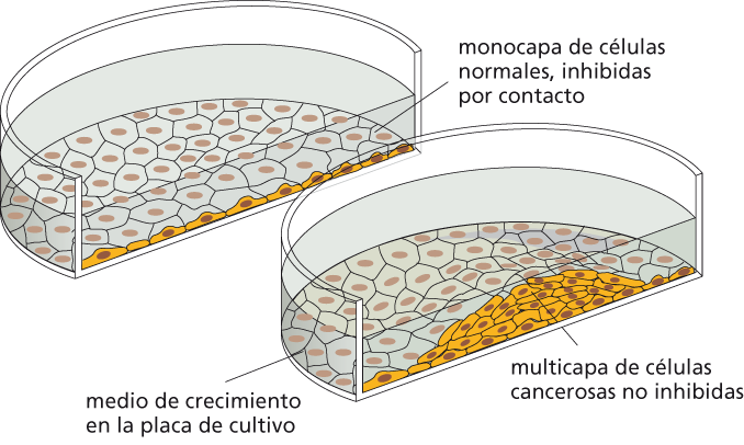 Células cancerosas en cultivo y pérdida de inhibición de contacto.