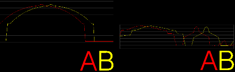 Cabeceo (pitch) Desalineación en radianes sobre el eje Y, entre la IMU y el láser,