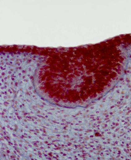 Anexos de la piel: GLÁNDULA MAMARIA Desarrollo embriológico: Botón mamario y
