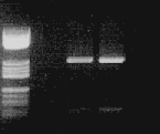 PCR de Hepatitis C donde vemos marcador de pesos moleculares, en el pocillo 2 
