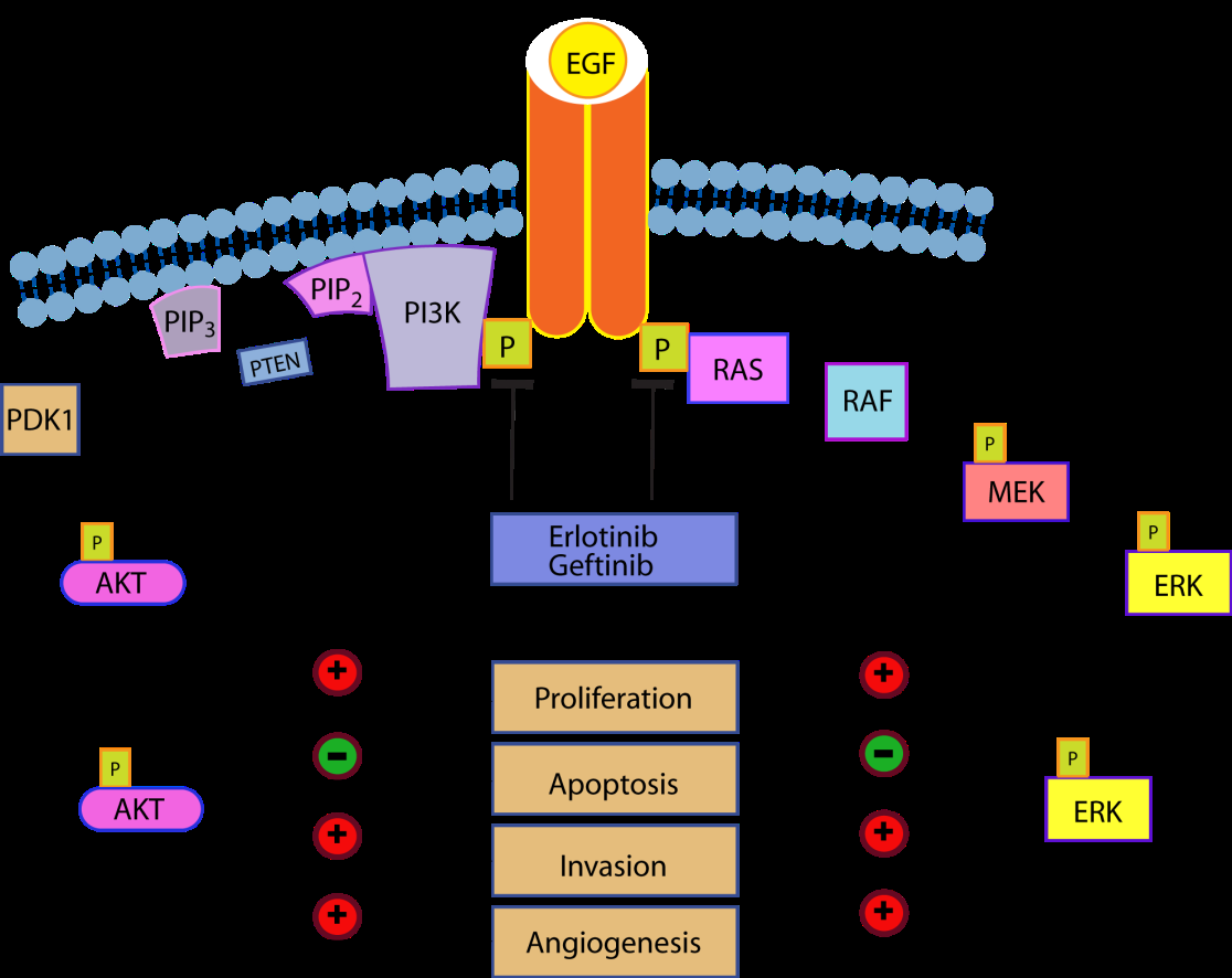 EGFR está disregulado en Glioma de alto grado Varios estudios fase II
