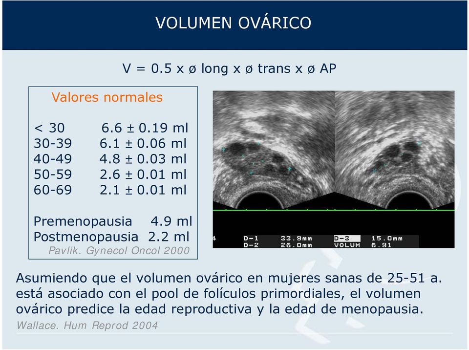 Gynecol Oncol 2000 Asumiendo que el volumen ovárico en mujeres sanas de 25-51 a.