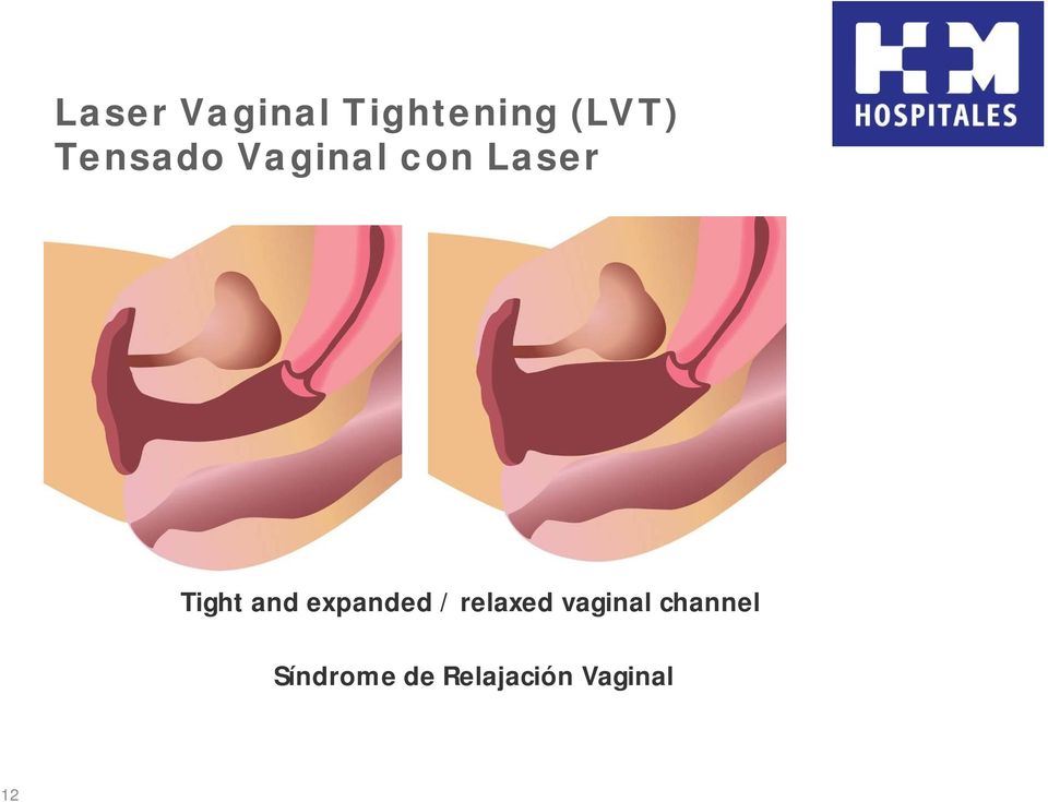 and expanded / relaxed vaginal