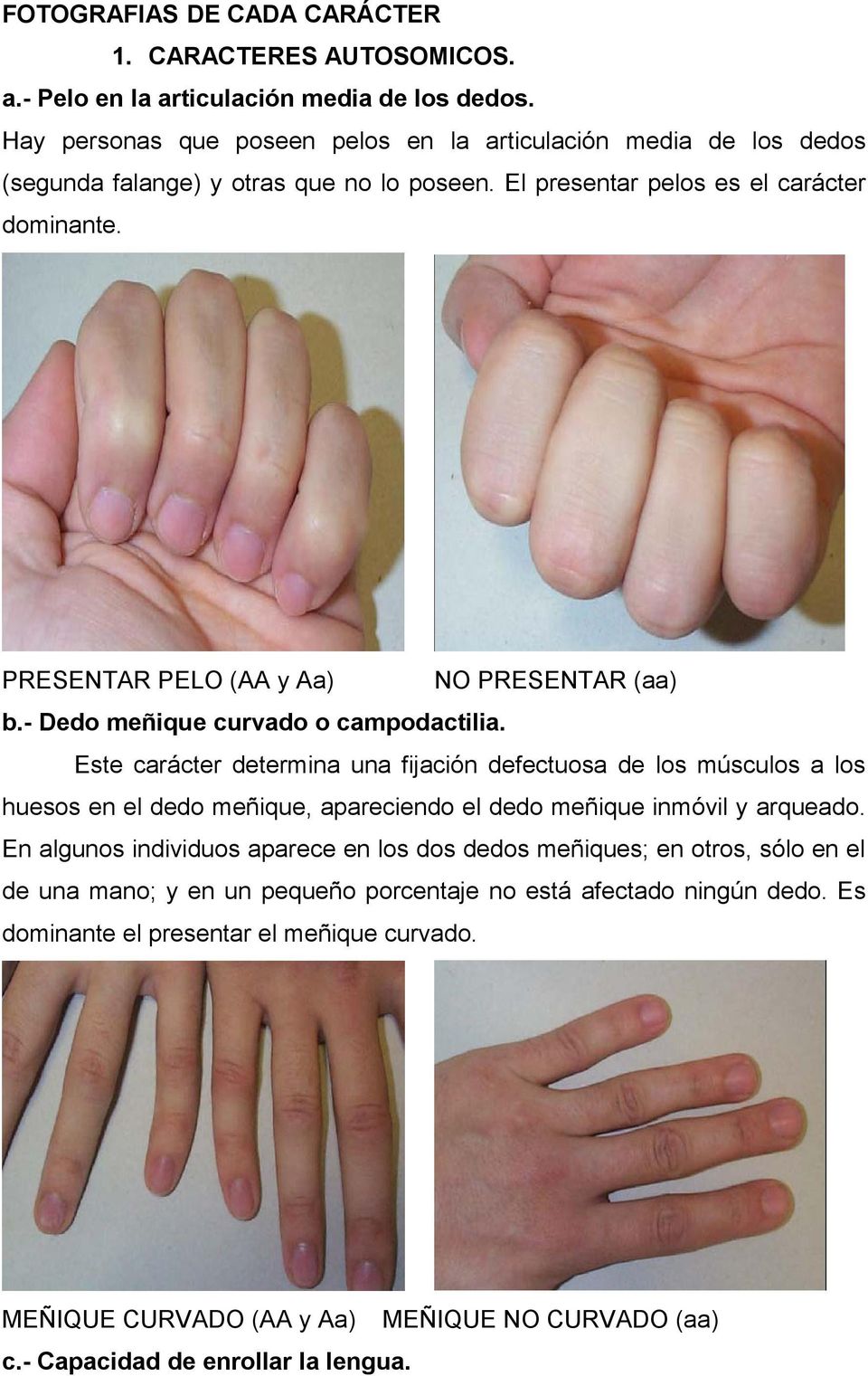 PRESENTAR PELO (AA y Aa) NO PRESENTAR (aa) b.- Dedo meñique curvado o campodactilia.