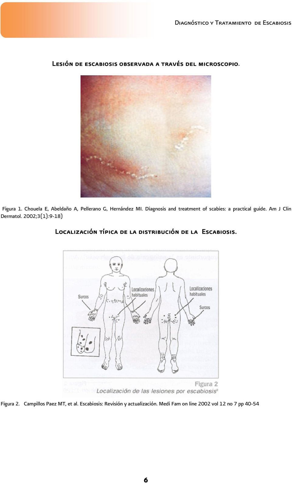 Diagnosis and treatment of scabies: a practical guide. Am J Clin Dermatol.