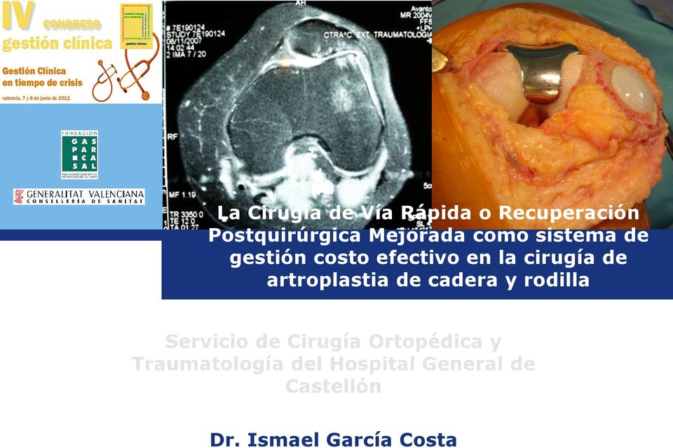 artroplastia de cadera y rodilla Servicio de Cirugía Ortopédica