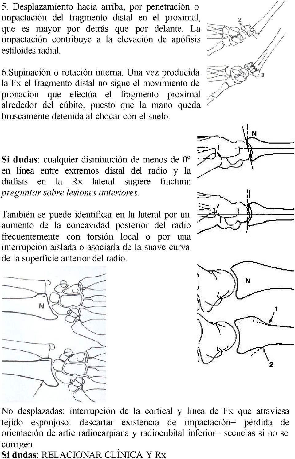 Una vez producida la Fx el fragmento distal no sigue el movimiento de pronación que efectúa el fragmento proximal alrededor del cúbito, puesto que la mano queda bruscamente detenida al chocar con el
