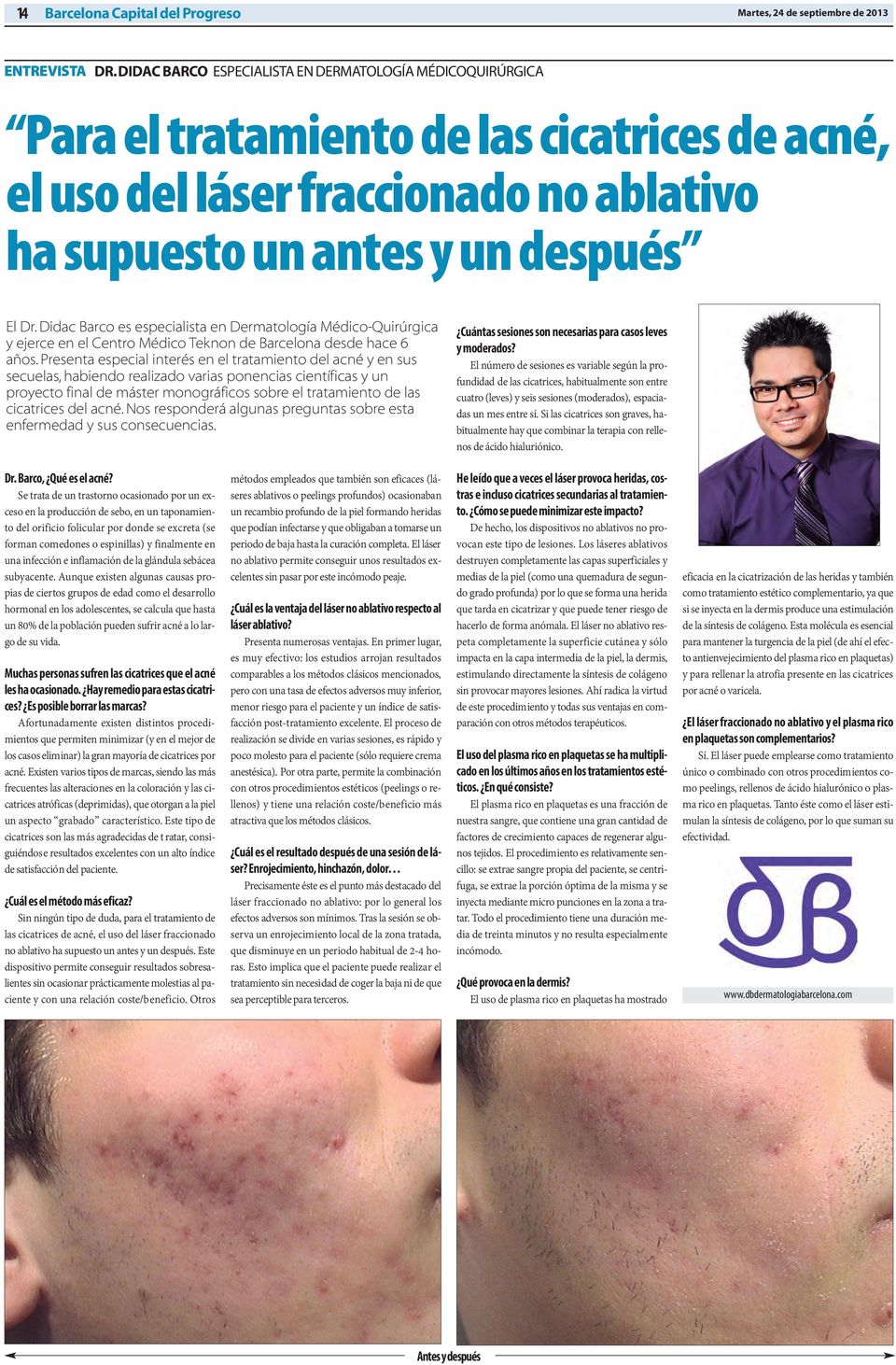 Didac Barco es especialista en Dermatología Médico-Quirúrgica y ejerce en el Centro Médico Teknon de Barcelona desde hace 6 años.