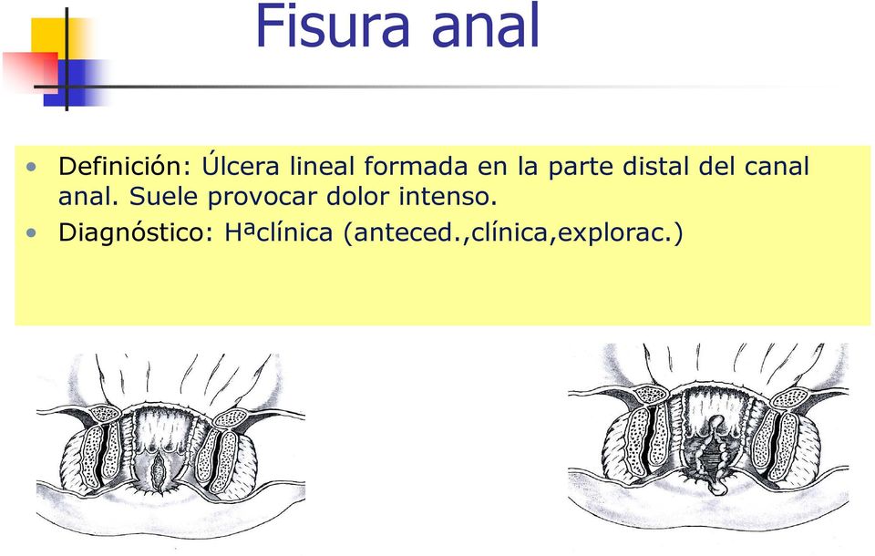 anal. Suele provocar dolor intenso.