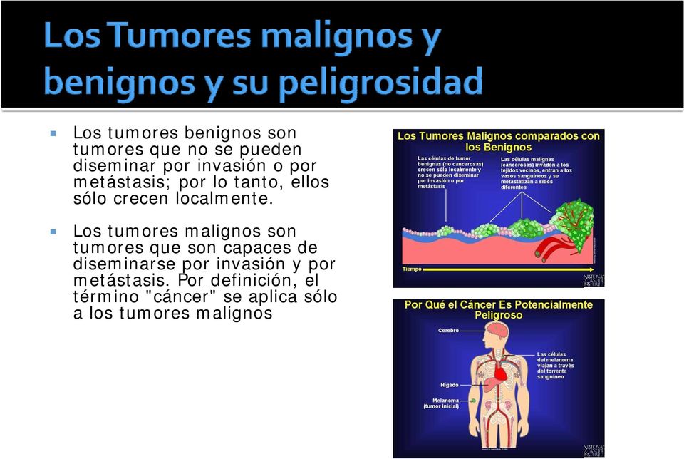 Los tumores malignos son tumores que son capaces de diseminarse por
