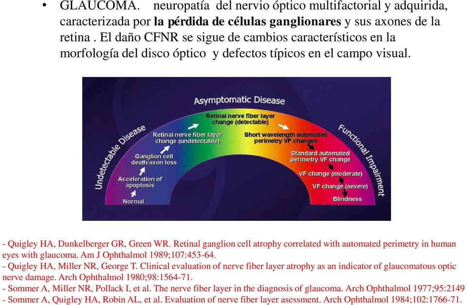Retinal ganglion cell atrophy correlated with automated perimetry in human eyes with glaucoma. Am J Ophthalmol 1989;107:453-64. - Quigley HA, Miller NR, George T.