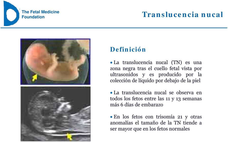 translucencia nucal se observa en todoslosfetosentrelas11y13semanas más 6 días de embarazo En los