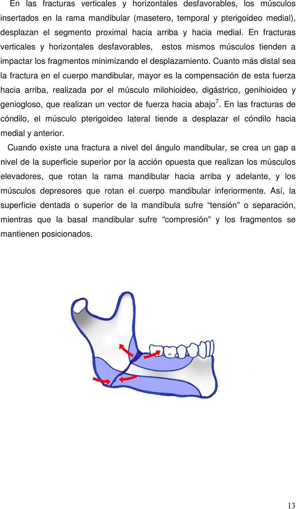 Cuanto más distal sea la fractura en el cuerpo mandibular, mayor es la compensación de esta fuerza hacia arriba, realizada por el músculo milohioideo, digástrico, genihioideo y geniogloso, que
