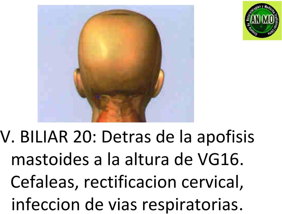 VG16. Cefaleas, rectificacion
