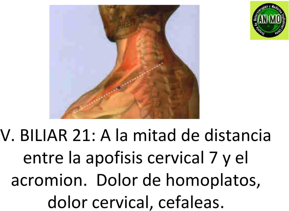 cervical 7 y el acromion.