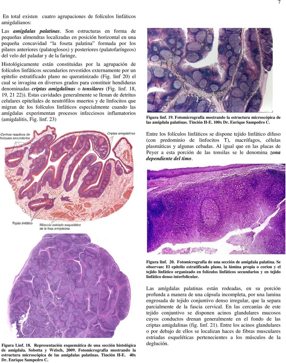 (palatofaríngeos) del velo del paladar y de la faringe, Histológicamente están constituidas por la agrupación de folículos linfáticos secundarios revestidos externamente por un epitelio estratificado