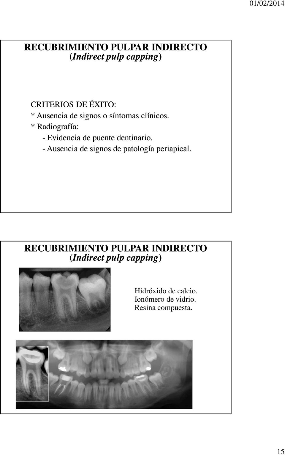 * Radiografía: - Evidencia de puente dentinario.