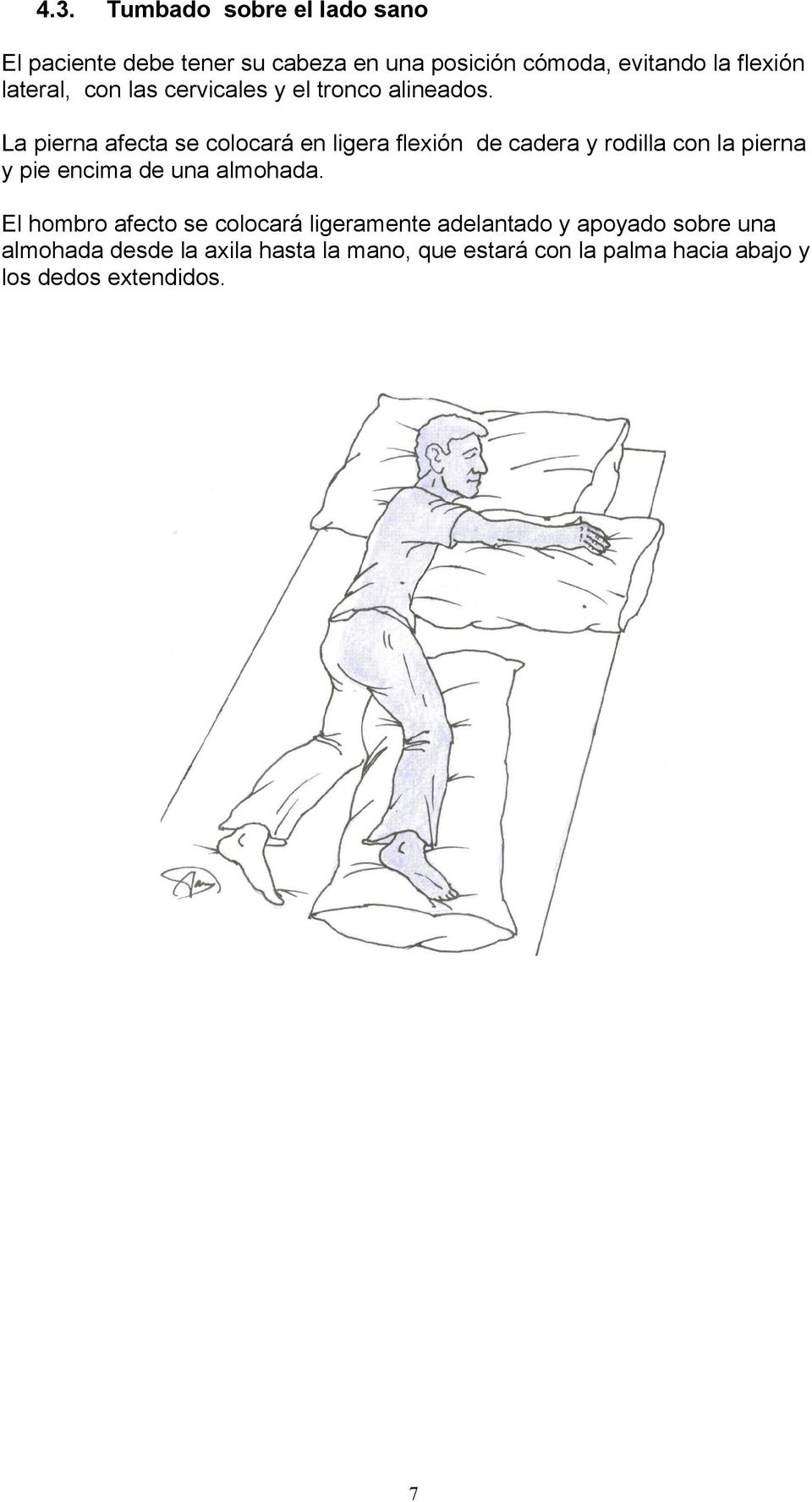 La pierna afecta se colocará en ligera flexión de cadera y rodilla con la pierna y pie encima de una almohada.