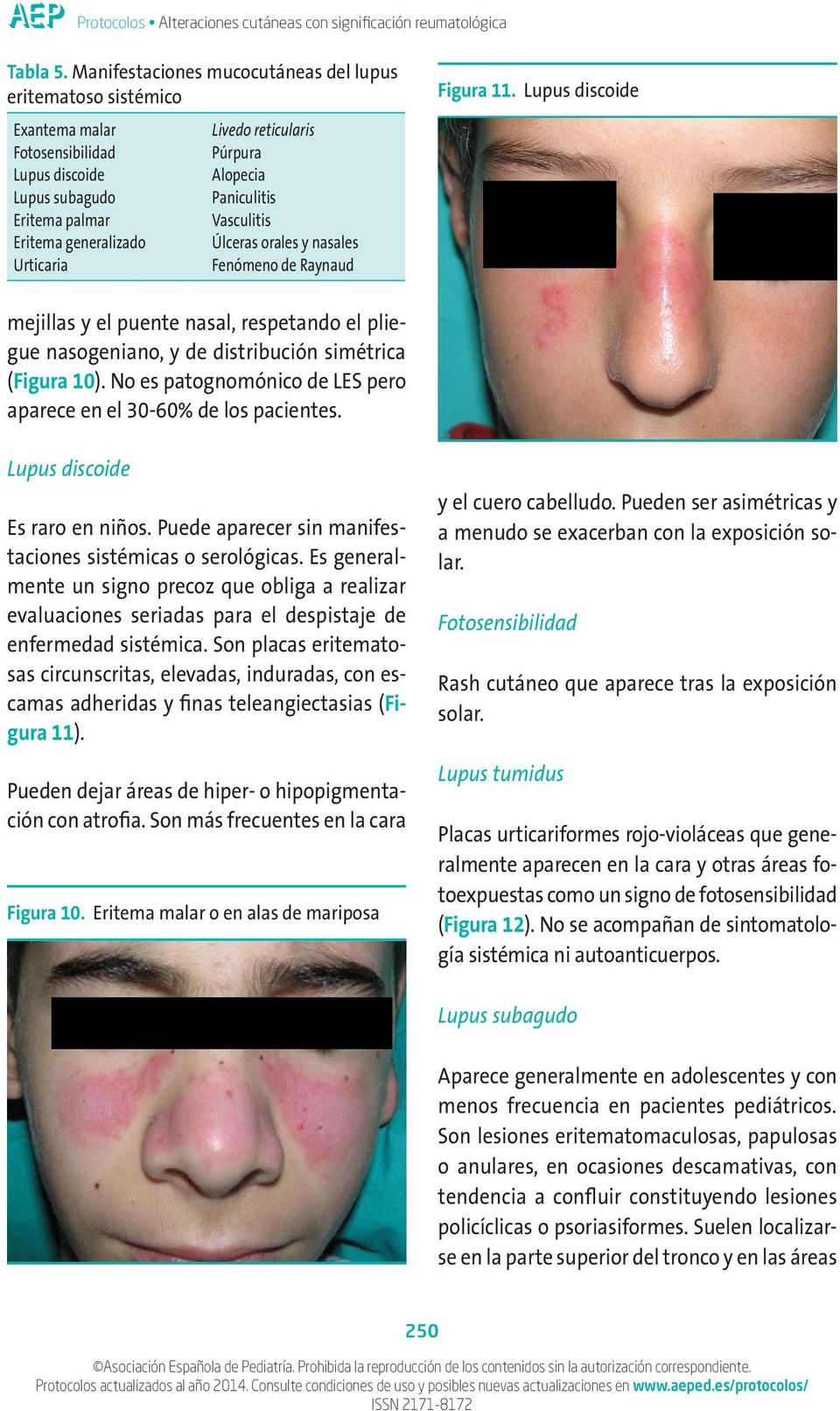 Alopecia Paniculitis Vasculitis Úlceras orales y nasales Fenómeno de Raynaud Figura 11.
