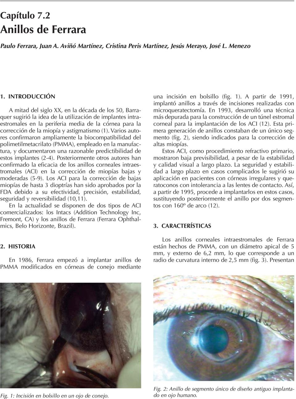 y astigmatismo (1).