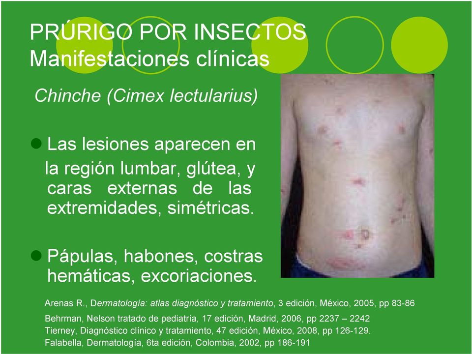 , Dermatología: atlas diagnóstico y tratamiento, 3 edición, México, 2005, pp 83-86 Behrman, Nelson tratado de pediatría, 17