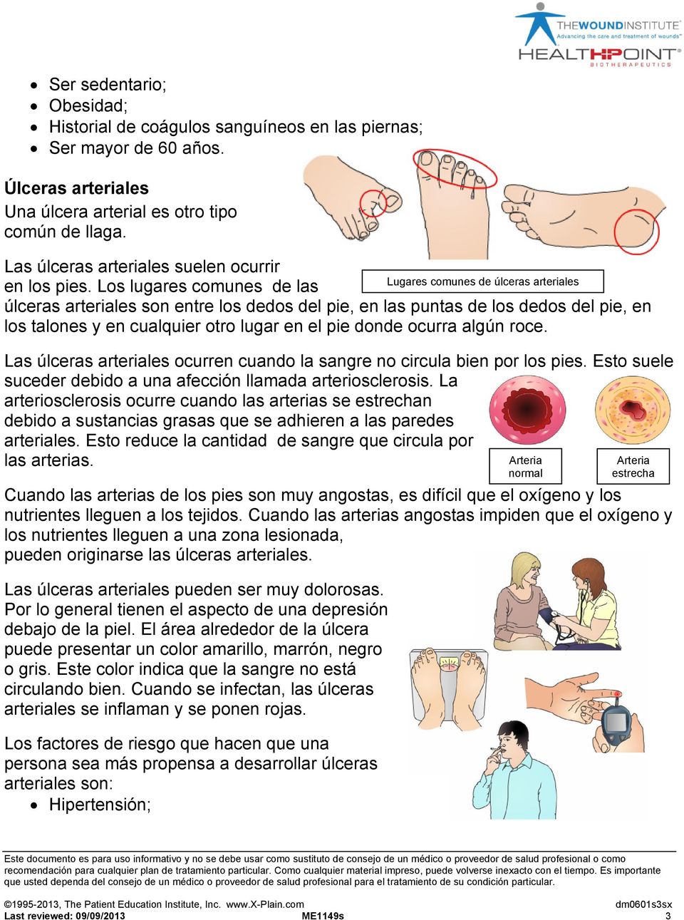 Los lugares comunes de las úlceras arteriales son entre los dedos del pie, en las puntas de los dedos del pie, en los talones y en cualquier otro lugar en el pie donde ocurra algún roce.