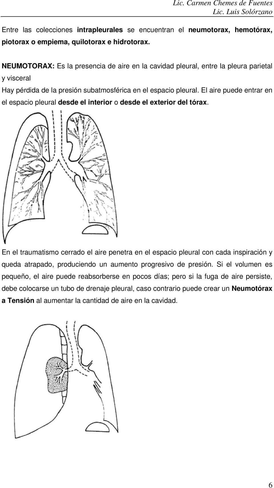 El aire puede entrar en el espacio pleural desde el interior o desde el exterior del tórax.