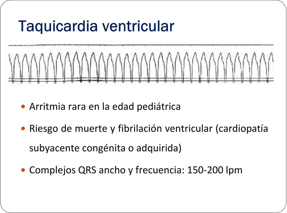 ventricular (cardiopatía subyacente congénita o