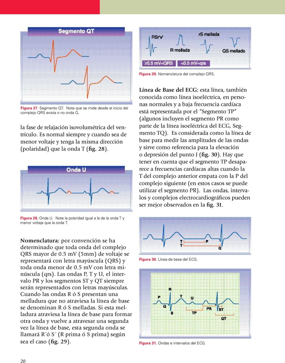 Línea de Base del ECG: esta línea, también conocida como línea isoeléctrica, en personas normales y a baja frecuencia cardíaca está representada por el Segmento TP (algunos incluyen el segmento PR