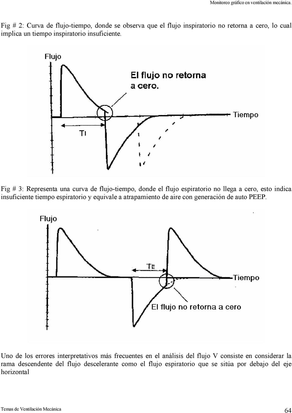 Fig # 3: Representa una curva de flujo-tiempo, donde el flujo espiratorio no llega a cero, esto indica insuficiente tiempo espiratorio y