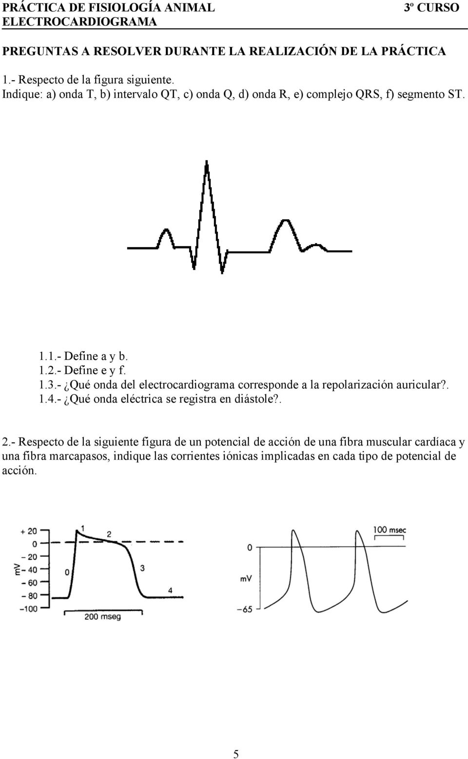 - Qué onda del electrocardiograma corresponde a la repolarización auricular?. 1.4.- Qué onda eléctrica se registra en diástole?. 2.