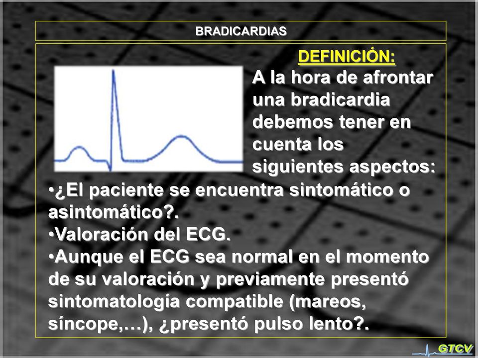 . Valoración del ECG.