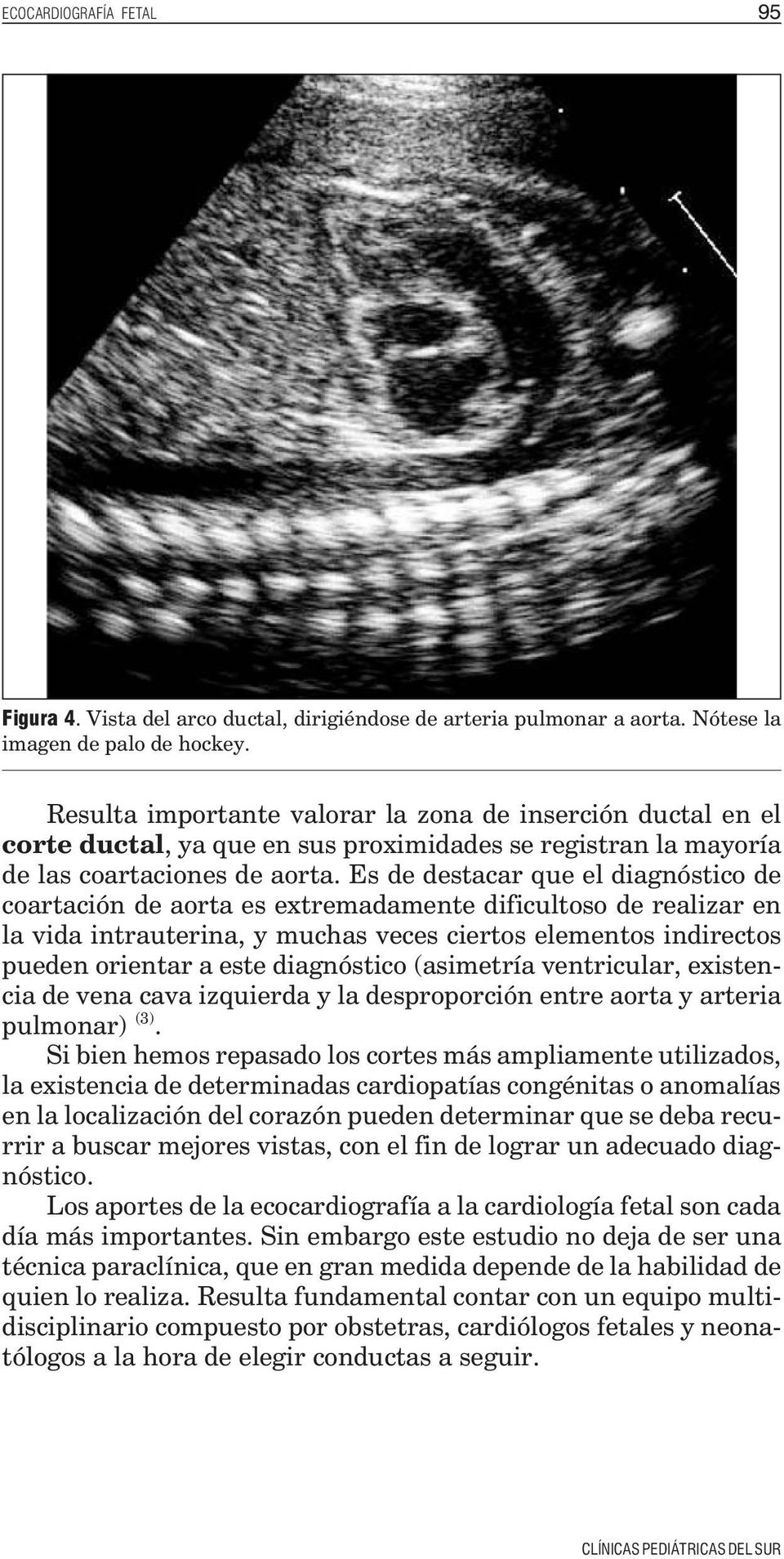 Es de destacar que el diagnóstico de coartación de aorta es extremadamente dificultoso de realizar en la vida intrauterina, y muchas veces ciertos elementos indirectos pueden orientar a este