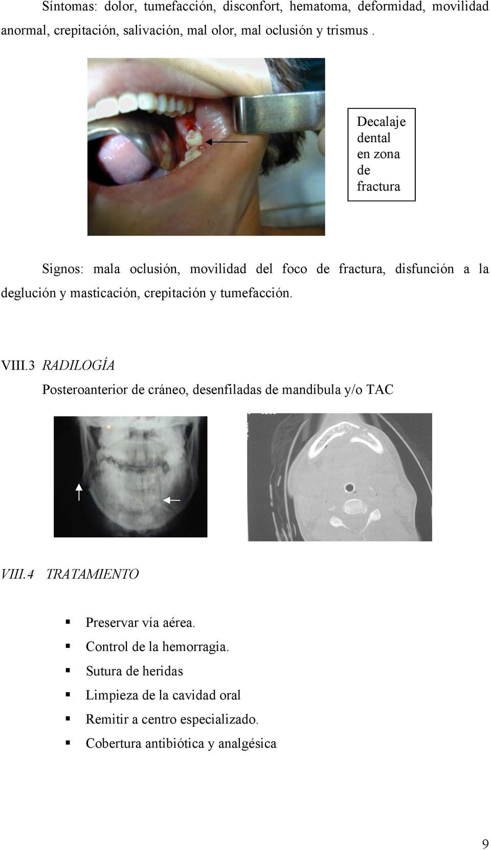 Decalaje dental en zona de fractura Signos: mala oclusión, movilidad del foco de fractura, disfunción a la deglución y masticación,