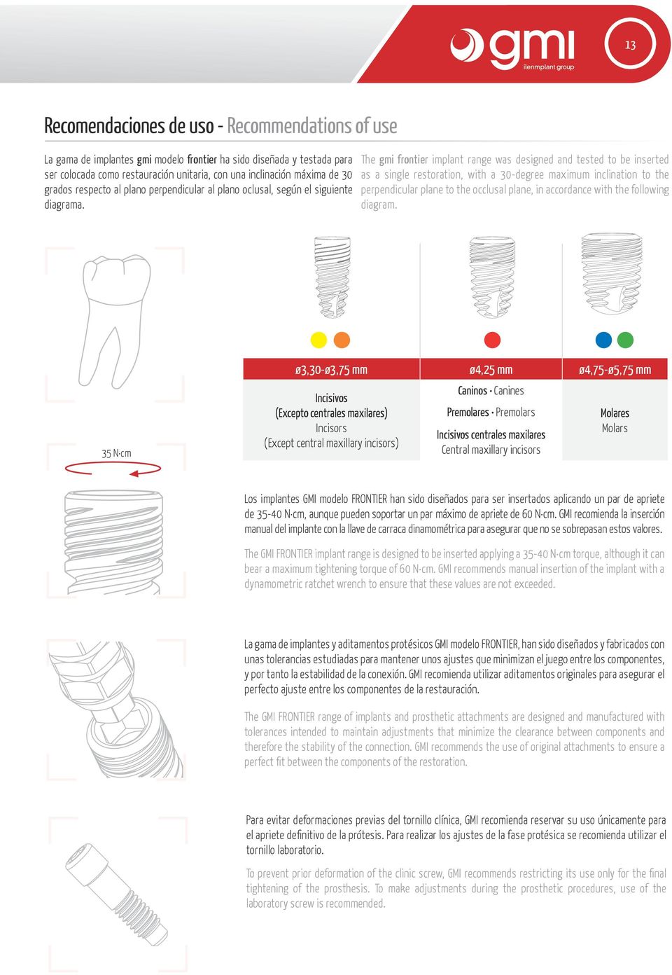The gmi frontier implant range was designed and tested to be inserted as a single restoration, with a 30-degree maximum inclination to the perpendicular plane to the occlusal plane, in accordance