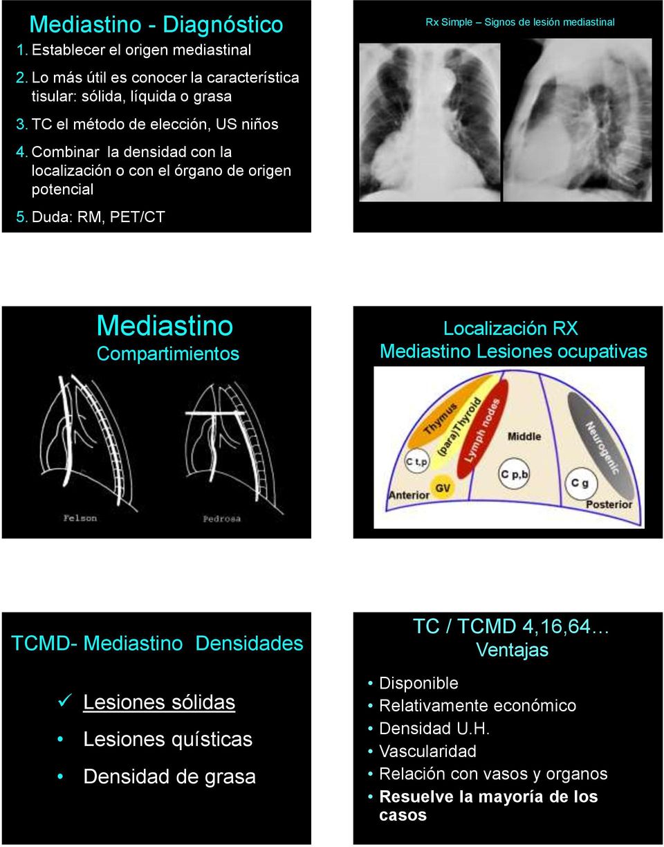 Duda: RM, PET/CT Rx Simple Signos de lesión mediastinal Mediastino Compartimientos Localización RX Mediastino Lesiones ocupativas TCMD- Mediastino