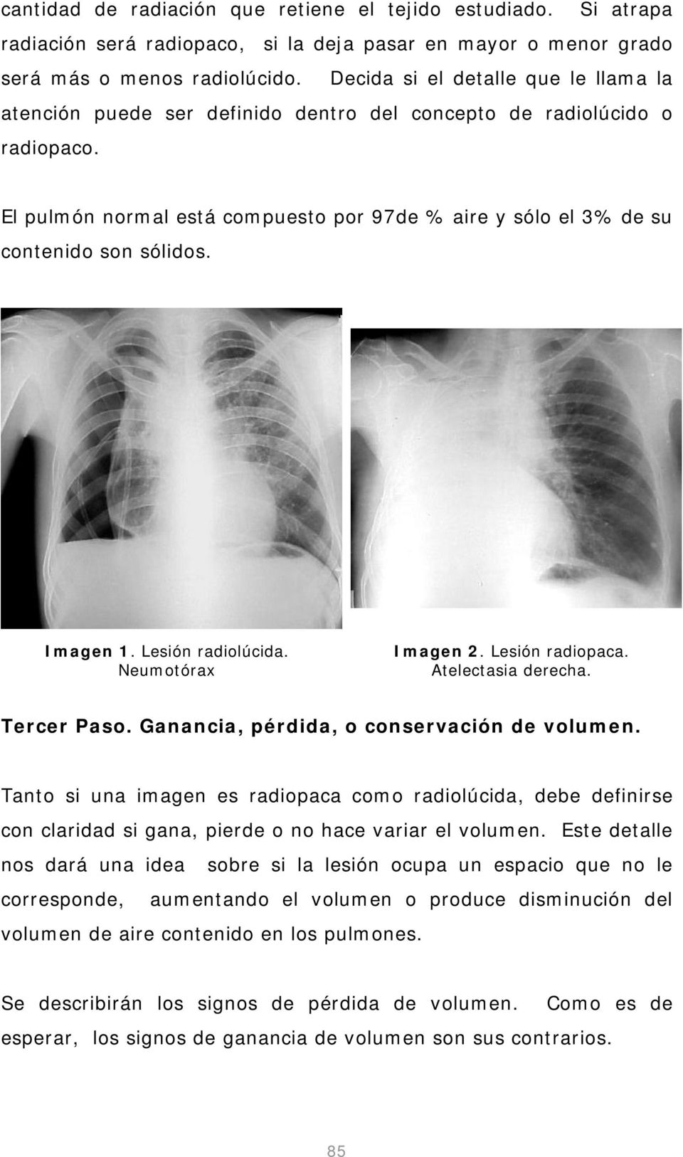 El pulmón normal está compuesto por 97de % aire y sólo el 3% de su contenido son sólidos. Imagen 1. Lesión radiolúcida. Neumotórax Imagen 2. Lesión radiopaca. Atelectasia derecha. Tercer Paso.