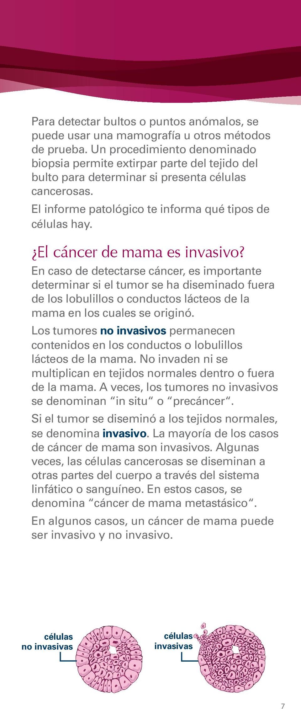 El cáncer de mama es invasivo? En caso de detectarse cáncer, es importante determinar si el tumor se ha diseminado fuera de los lobulillos o conductos lácteos de la mama en los cuales se originó.