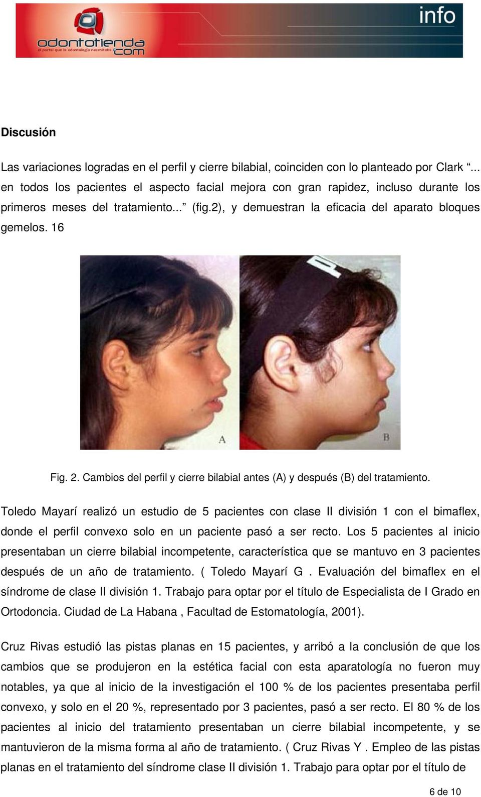 Cambios del perfil y cierre bilabial antes (A) y después (B) del tratamiento.