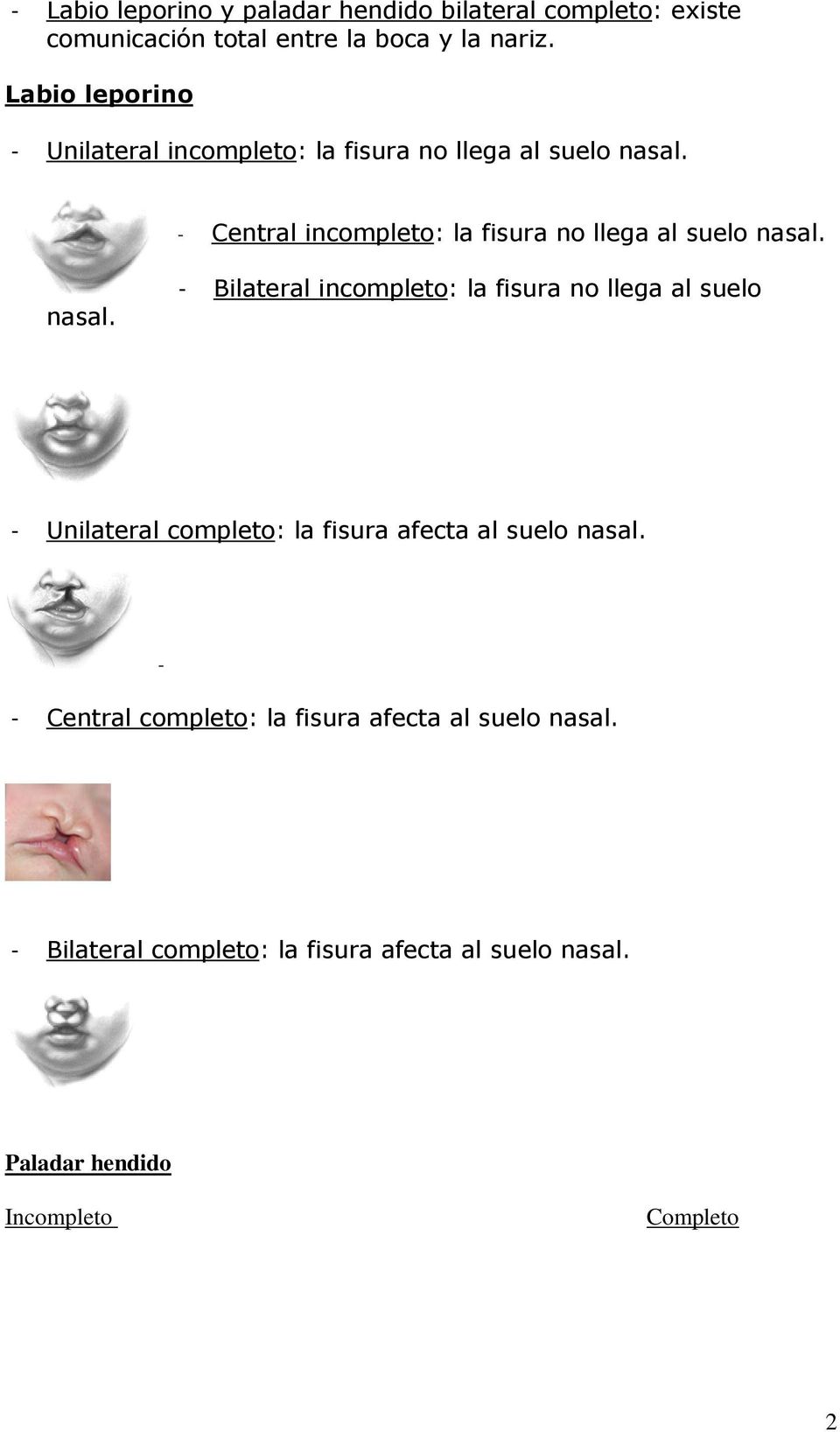 - Central incompleto: la fisura no llega al suelo nasal.