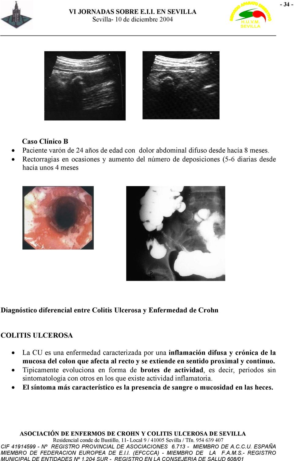 COLITIS ULCEROSA La CU es una enfermedad caracterizada por una inflamación difusa y crónica de la mucosa del colon que afecta al recto y se extiende en sentido proximal y