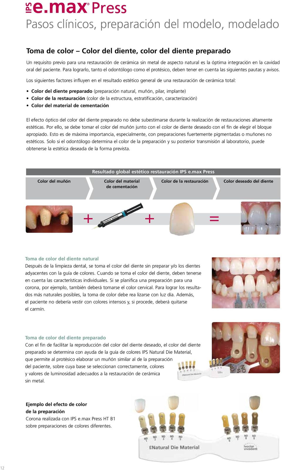 Los siguientes factores influyen en el resultado estético general de una restauración de cerámica total: Color del diente preparado (preparación natural, muñón, pilar, implante) Color de la