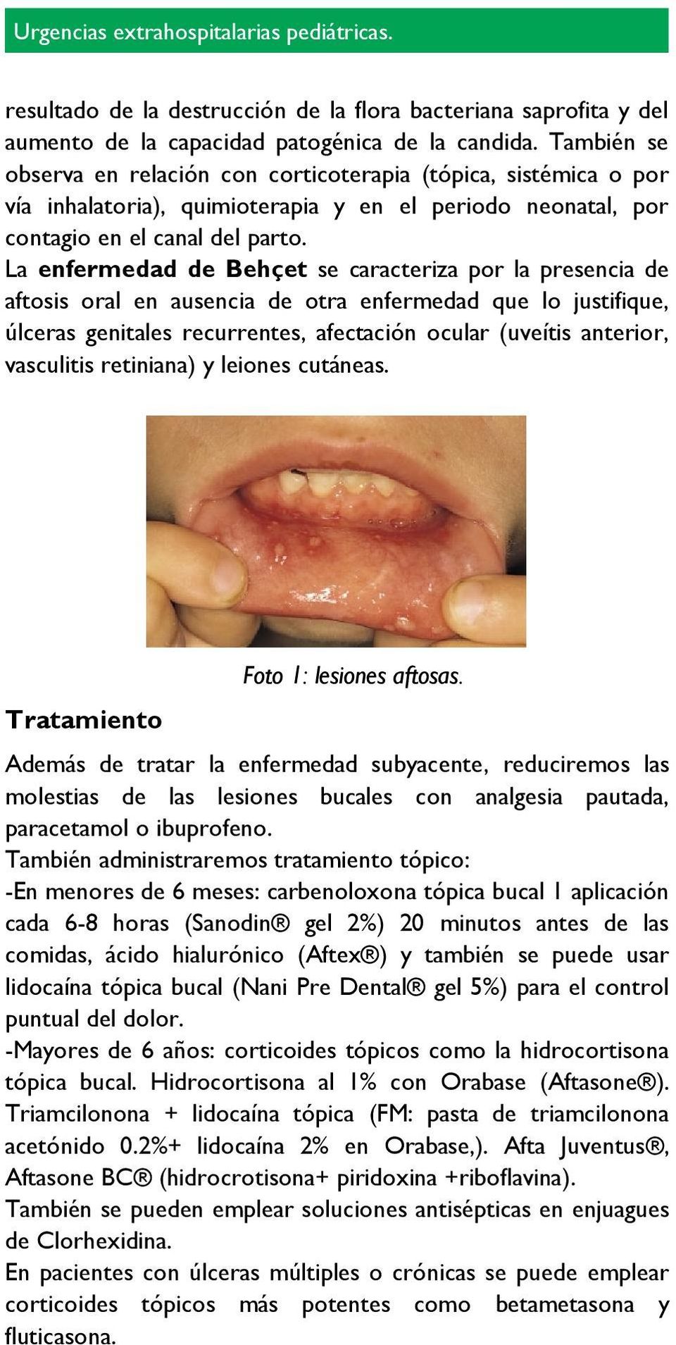 La enfermedad de Behçet se caracteriza por la presencia de aftosis oral en ausencia de otra enfermedad que lo justifique, úlceras genitales recurrentes, afectación ocular (uveítis anterior,
