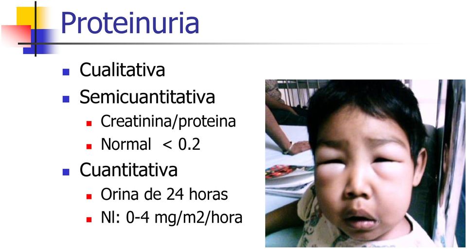 Creatinina/proteina Normal < 0.