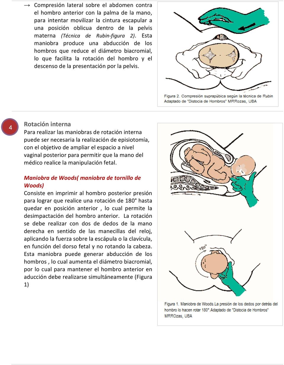 4 Rotación interna Para realizar las maniobras de rotación interna puede ser necesaria la realización de episiotomía, con el objetivo de ampliar el espacio a nivel vaginal posterior para permitir que