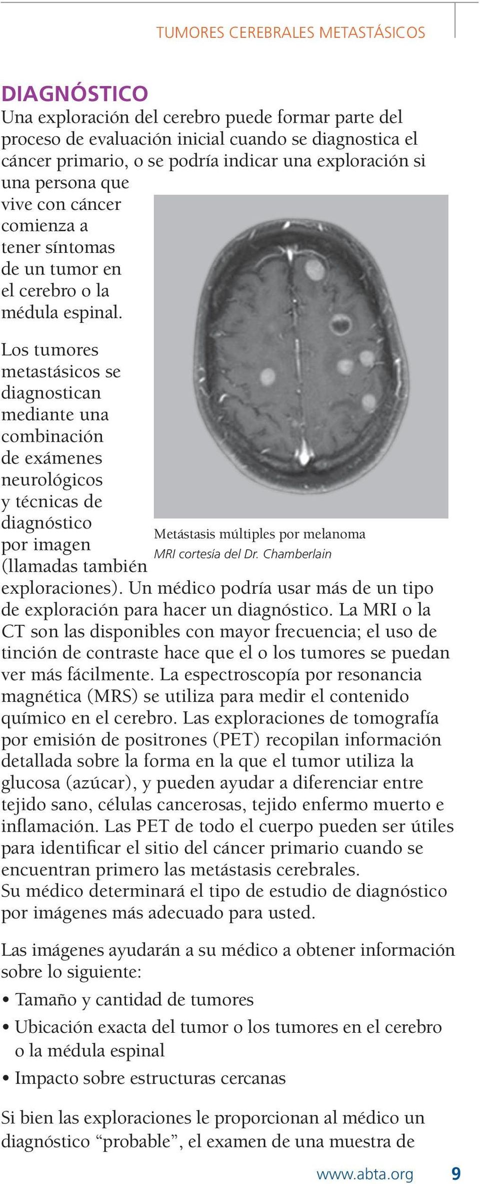 Los tumores metastásicos se diagnostican mediante una combinación de exámenes neurológicos y técnicas de diagnóstico Metástasis múltiples por melanoma por imagen MRI cortesía del Dr.